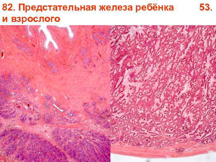 82. Предстательная железа ребёнка 53. и взрослого 82. Предстательная железа ребёнка 53. и взрослого