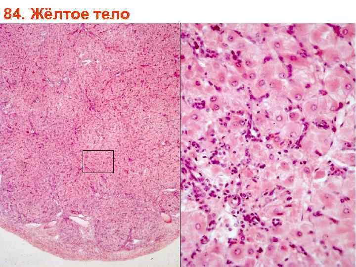 84. Жёлтое тело 84. Жёлтое тело