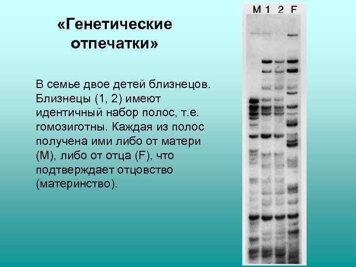   «Генетические отпечатки»  В семье двое детей близнецов. Близнецы (1, 2) имеют