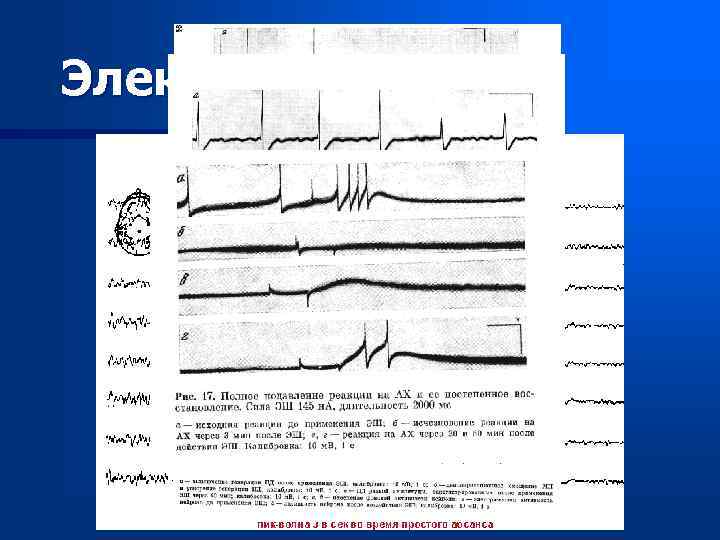 Электрошок 