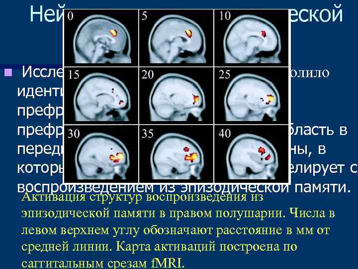  Нейроанатомия эпизодической    памяти n  Исследование при помощи ПЭТ позволило
