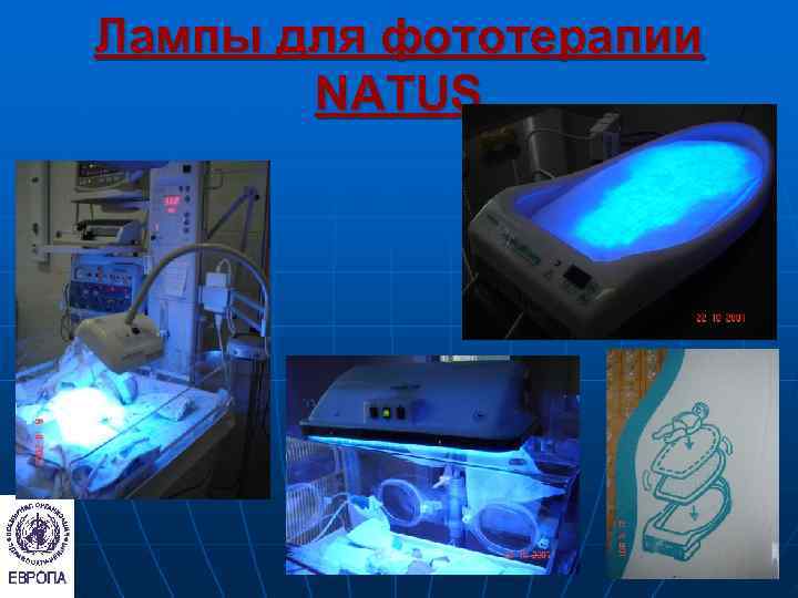Лампы для фототерапии  NATUS 