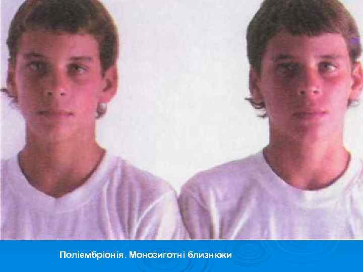 Поліембріонія. Монозиготні близнюки 