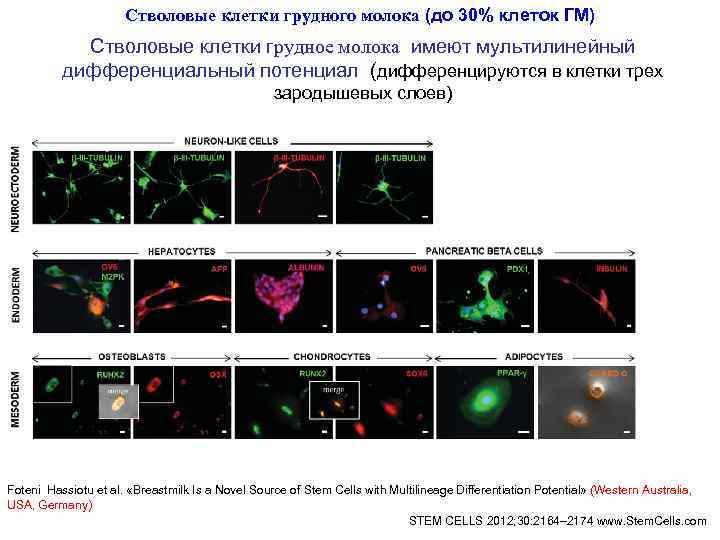 Стволовые клетки грудного молока (до 30% клеток ГМ) Стволовые клетки грудного молока (до 30% клеток ГМ)