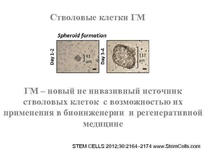 Стволовые клетки ГМ – новый не инвазивный источник стволовых клеток с Стволовые клетки ГМ – новый не инвазивный источник стволовых клеток с