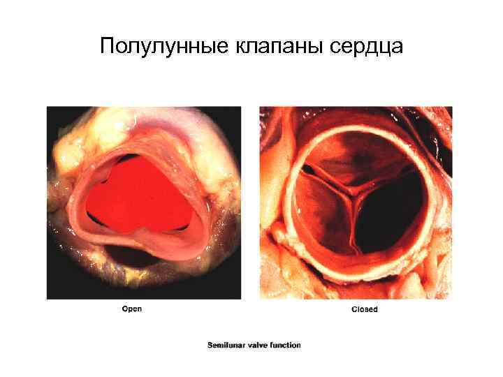 Полулунные клапаны сердца 