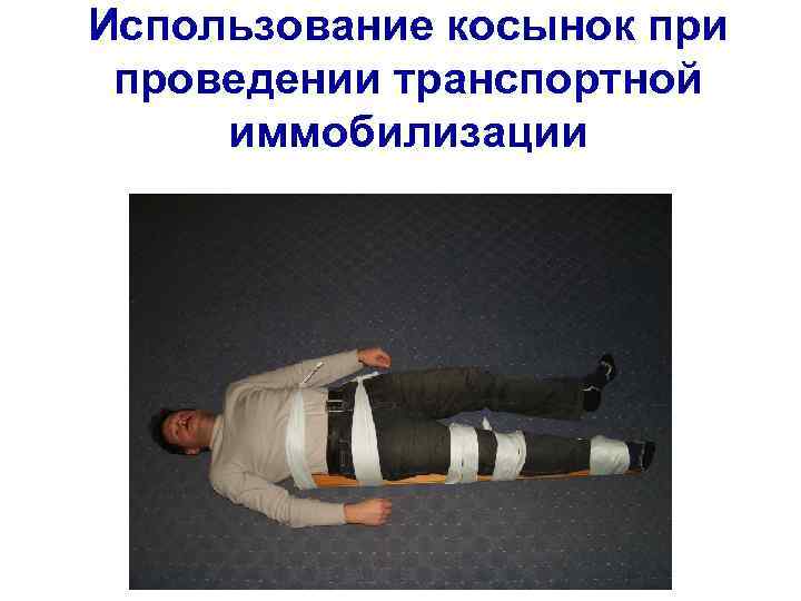 Использование косынок при проведении транспортной иммобилизации 
