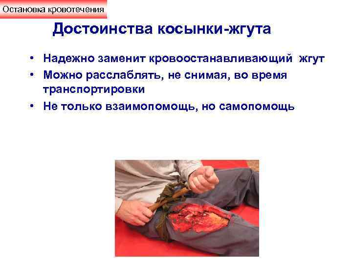 Остановка кровотечения  Достоинства косынки-жгута  • Надежно заменит кровоостанавливающий жгут  • Можно