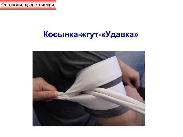 Остановка кровотечения     Косынка-жгут- «Удавка» 