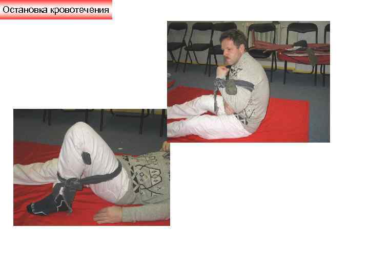 Остановка кровотечения 