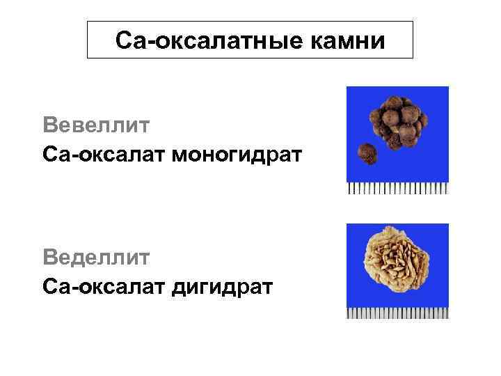 Картинки оксалата в реальной жизни