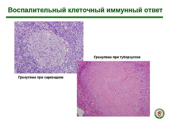 Воспалительный клеточный иммунный ответ 