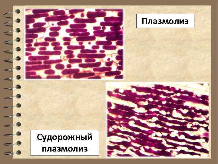    Плазмолиз Судорожный  плазмолиз 