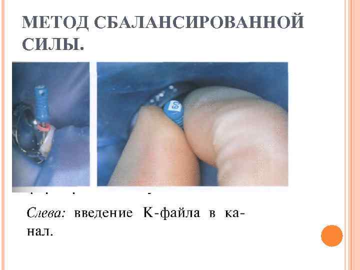 МЕТОД СБАЛАНСИРОВАННОЙ СИЛЫ. 