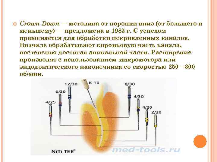 Схема crown down