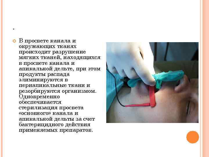 . В просвете канала и окружающих тканях происходит разрушение мягких тканей, находящихся в просвете