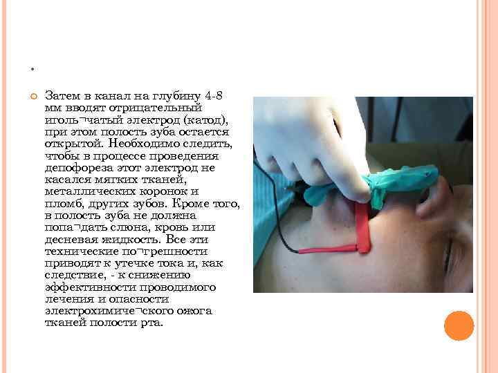 . Затем в канал на глубину 4 -8 мм вводят отрицательный иголь¬чатый электрод (катод),