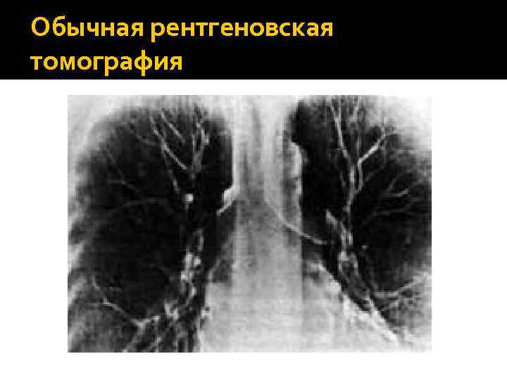 В каких случаях показана компьютерная рентгеновская томография пораженного сустава тест