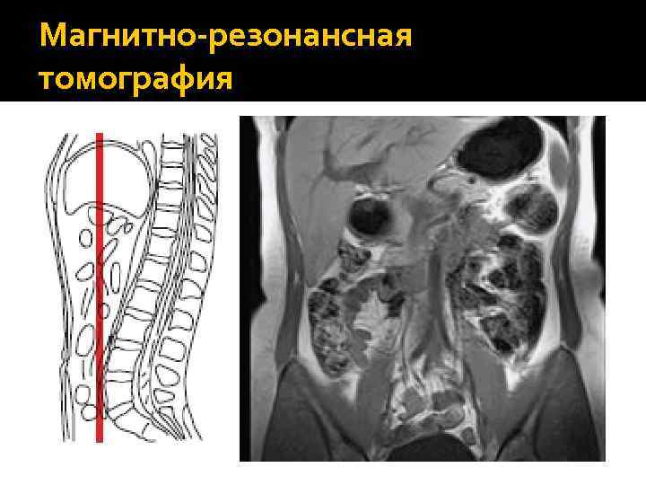 Магнитно-резонансная томография 