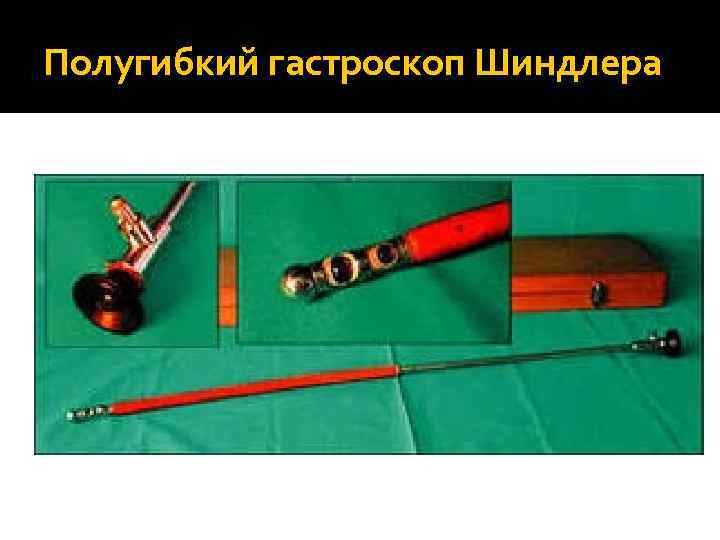 Полугибкий гастроскоп Шиндлера 