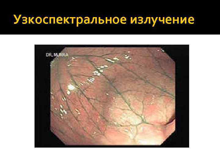 Узкоспектральное излучение 