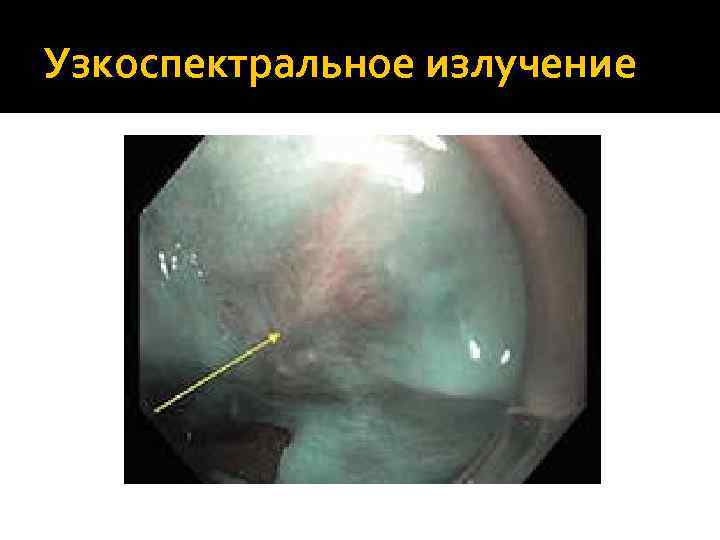 Узкоспектральное излучение 