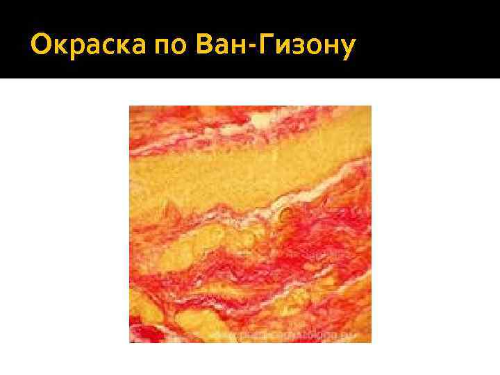 Окраска по Ван-Гизону 