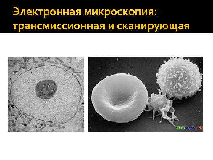 Электронная микроскопия: трансмиссионная и сканирующая 