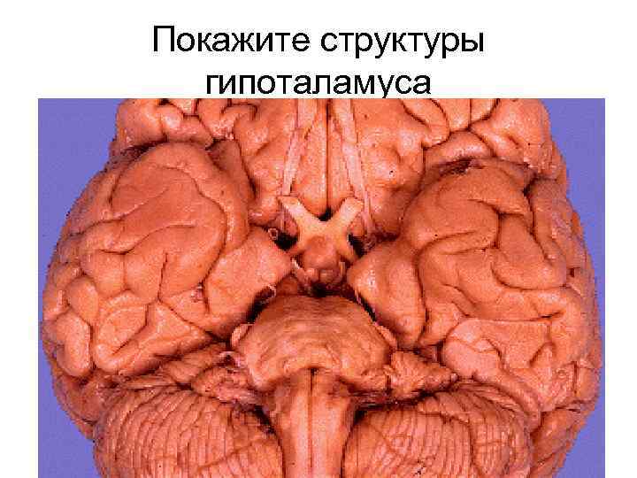 Покажите структуры  гипоталамуса 