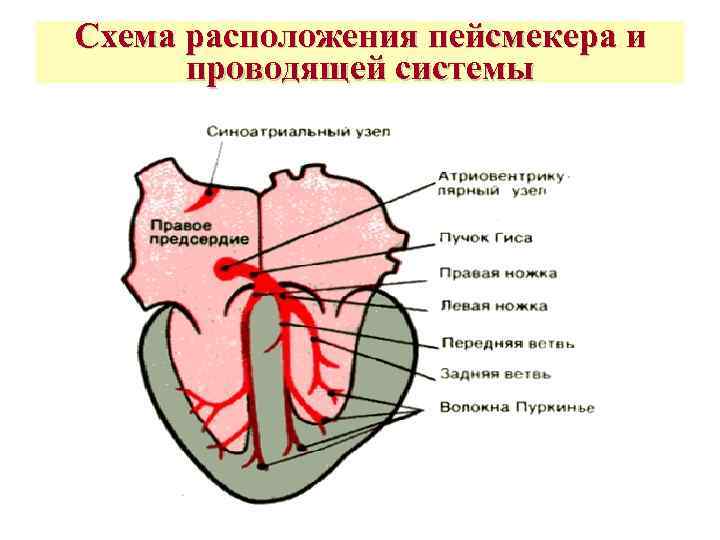 Схема расположения пейсмекера и  проводящей системы 