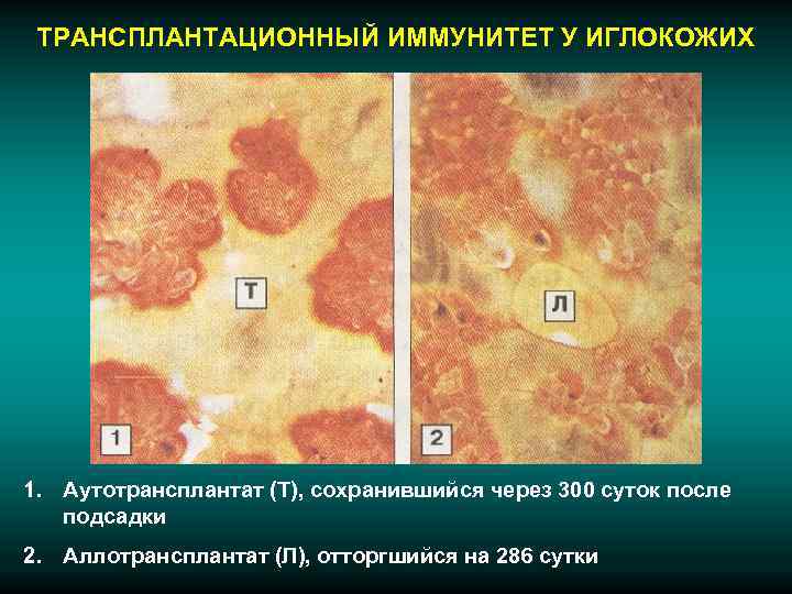  ТРАНСПЛАНТАЦИОННЫЙ ИММУНИТЕТ У ИГЛОКОЖИХ 1. Аутотрансплантат (Т), сохранившийся через 300 суток после 