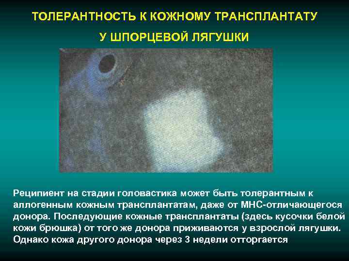   ТОЛЕРАНТНОСТЬ К КОЖНОМУ ТРАНСПЛАНТАТУ   У ШПОРЦЕВОЙ ЛЯГУШКИ Реципиент на стадии