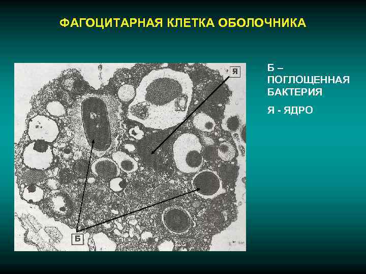 ФАГОЦИТАРНАЯ КЛЕТКА ОБОЛОЧНИКА      Б–     ПОГЛОЩЕННАЯ