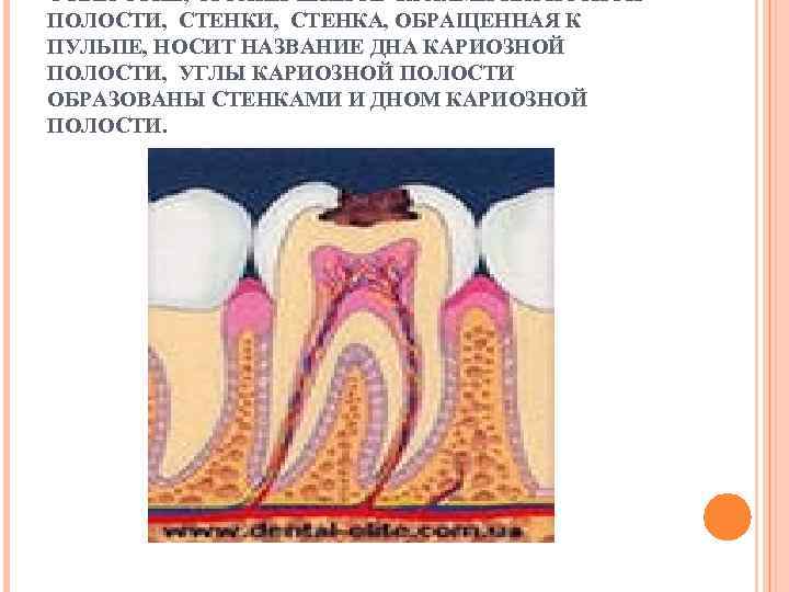 Дном кариозной полости принято считать стенку