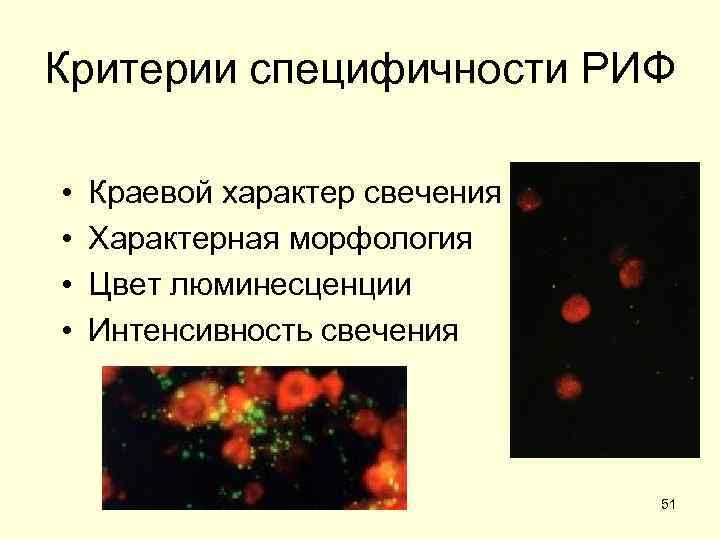 Критерии специфичности РИФ  •  Краевой характер свечения •  Характерная морфология •