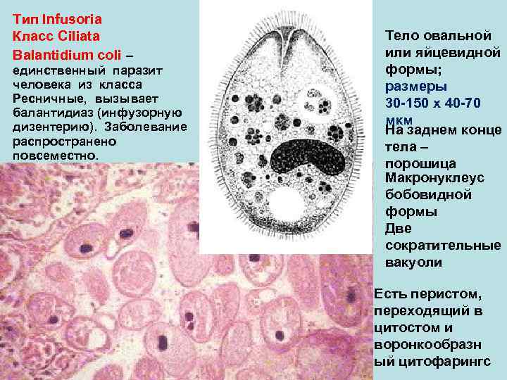 Тип Infusoria Класс Ciliata    Тело овальной Balantidium coli –  