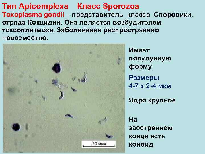Токсоплазмоз микробиология презентация