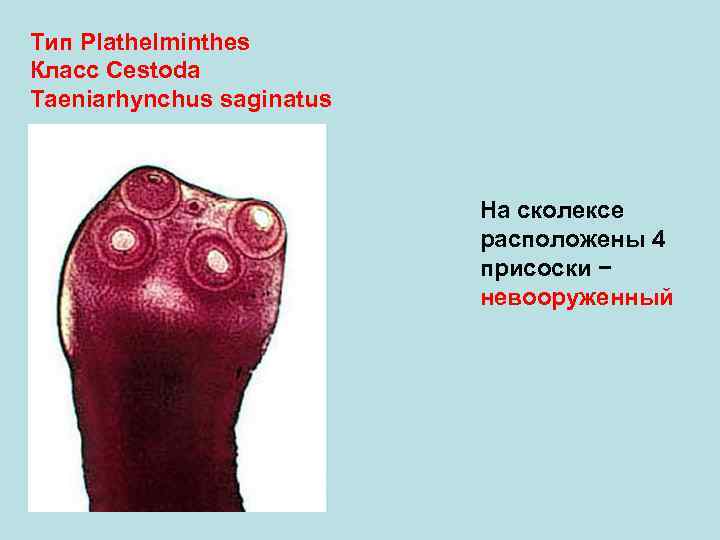 Тип Plathelminthes Класс Cestoda Taeniarhynchus saginatus       На сколексе