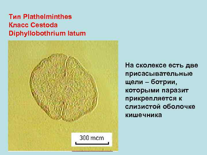 Тип Plathelminthes Класс Cestoda Diphyllobothrium latum     На сколексе есть две
