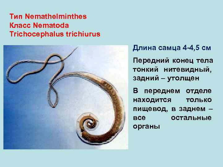 Тип Nemathelminthes Класс Nematoda Trichocephalus trichiurus     Длина самца 4 -4,