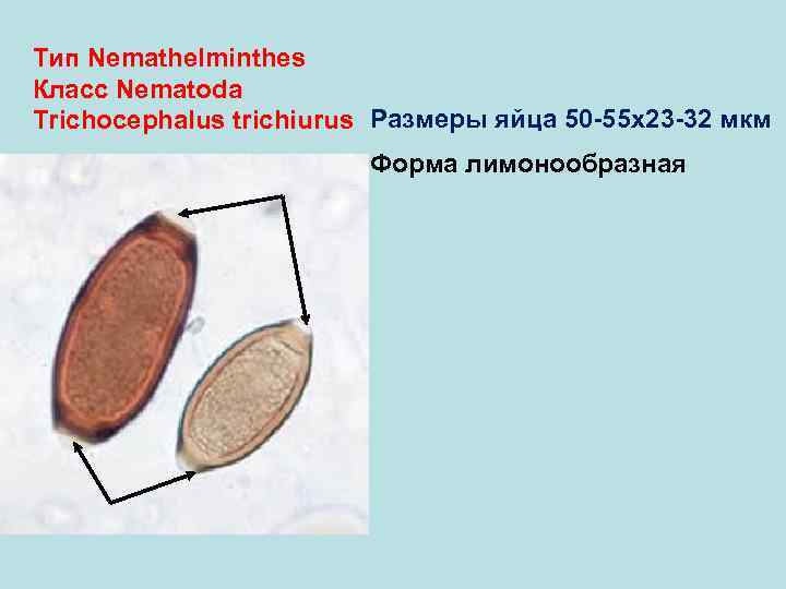 Тип Nemathelminthes Класс Nematoda Trichocephalus trichiurus Размеры яйца 50 -55 х23 -32 мкм 