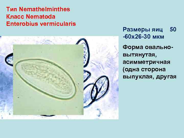 Тип Nemathelminthes Класс Nematoda Enterobius vermicularis      Размеры яиц 50