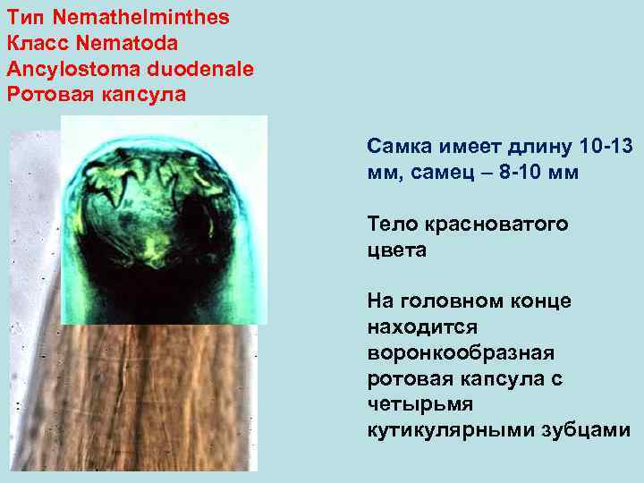 Тип Nemathelminthes Класс Nematoda Ancylostoma duodenale Ротовая капсула     Самка имеет