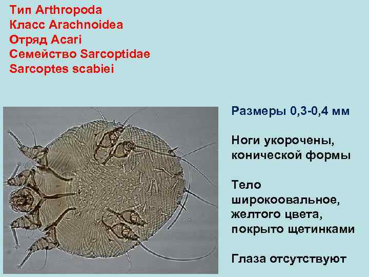 Тип Arthropoda Класс Arachnoidea Отряд Аcari Семейство Sarcoptidae Sarcoptes scabiei    