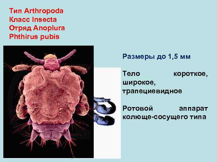 Тип Arthropoda Класс Insecta Отряд Anoplura Phthirus pubis    Размеры до 1,