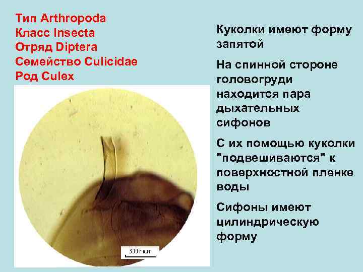 Тип Arthropoda Класс Insecta   Куколки имеют форму Отряд Diptera   запятой