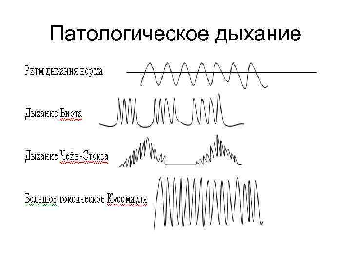Патологическое дыхание 