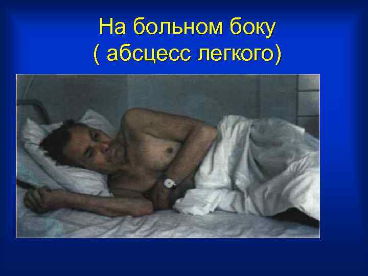  На больном боку ( абсцесс легкого) 