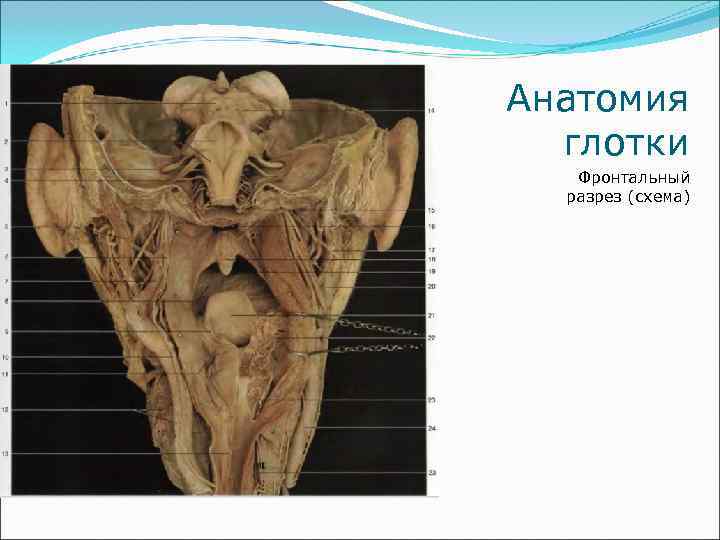 Анатомия  глотки  Фронтальный  разрез (схема) 