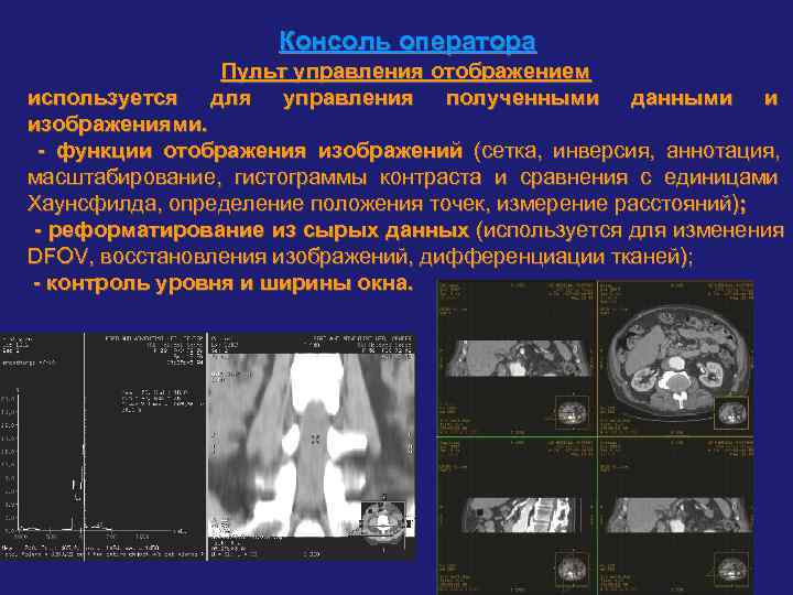      Консоль оператора   Пульт управления отображением используется 